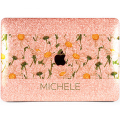 Lex Altern MacBook Glitter Case Daisy Flowers