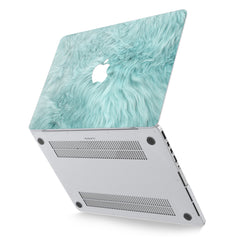 Lex Altern Hard Plastic MacBook Case Blue Fur