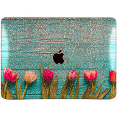 Lex Altern MacBook Glitter Case Tulip Design