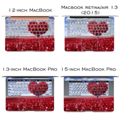 Lex Altern Vinyl MacBook Skin Love Field