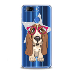 Lex Altern TPU Silicone Lenovo Case Cute Basset Hound