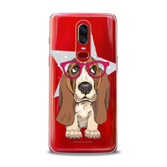 Lex Altern TPU Silicone OnePlus Case Cute Basset Hound