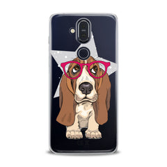 Lex Altern TPU Silicone Nokia Case Cute Basset Hound