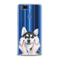 Lex Altern TPU Silicone Lenovo Case Charming Husky