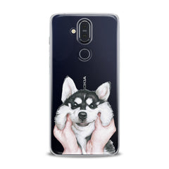 Lex Altern TPU Silicone Nokia Case Charming Husky