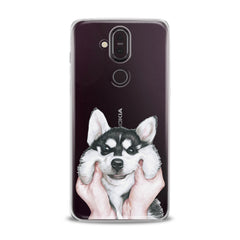 Lex Altern TPU Silicone Nokia Case Charming Husky