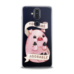 Lex Altern TPU Silicone Nokia Case Cute Pink Pig