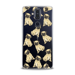 Lex Altern TPU Silicone Nokia Case Puppy Pug