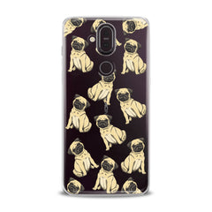 Lex Altern TPU Silicone Nokia Case Puppy Pug