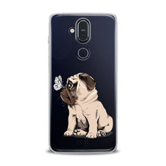 Lex Altern TPU Silicone Nokia Case Cute Puppy Pug