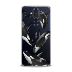 Lex Altern TPU Silicone Nokia Case Watercolor Killer Whales