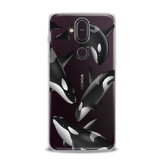 Lex Altern TPU Silicone Nokia Case Watercolor Killer Whales